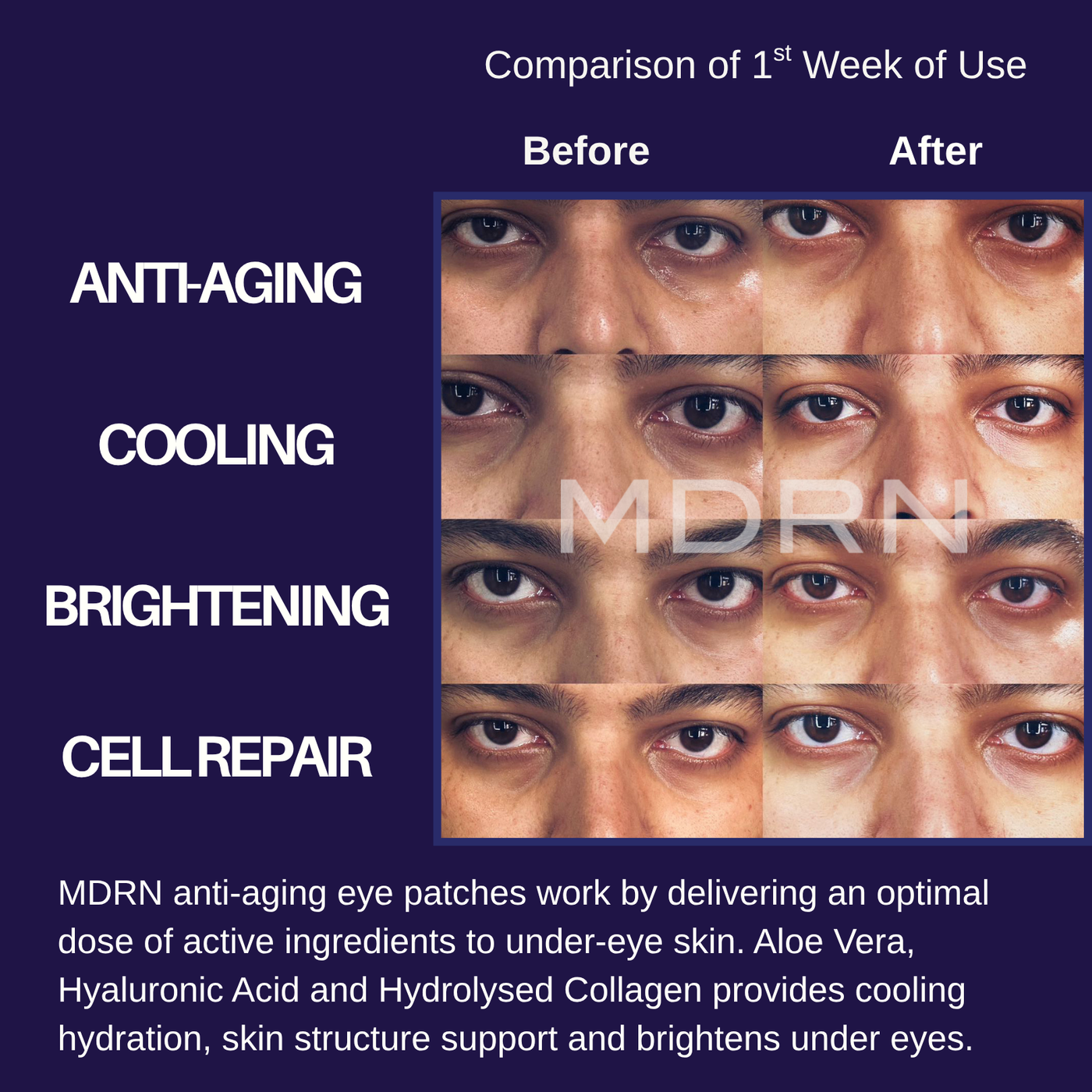 Hydrogel Eyepatches - Cooling & Anti-Aging